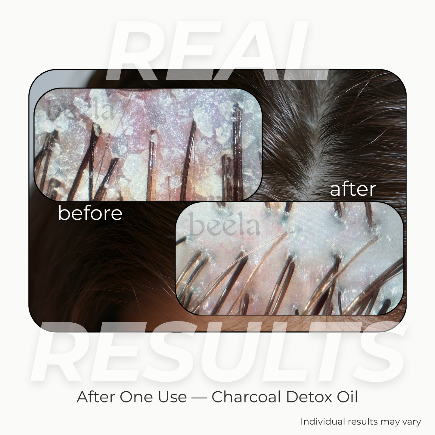Charcoal Detox Scalp Oil - 2oz