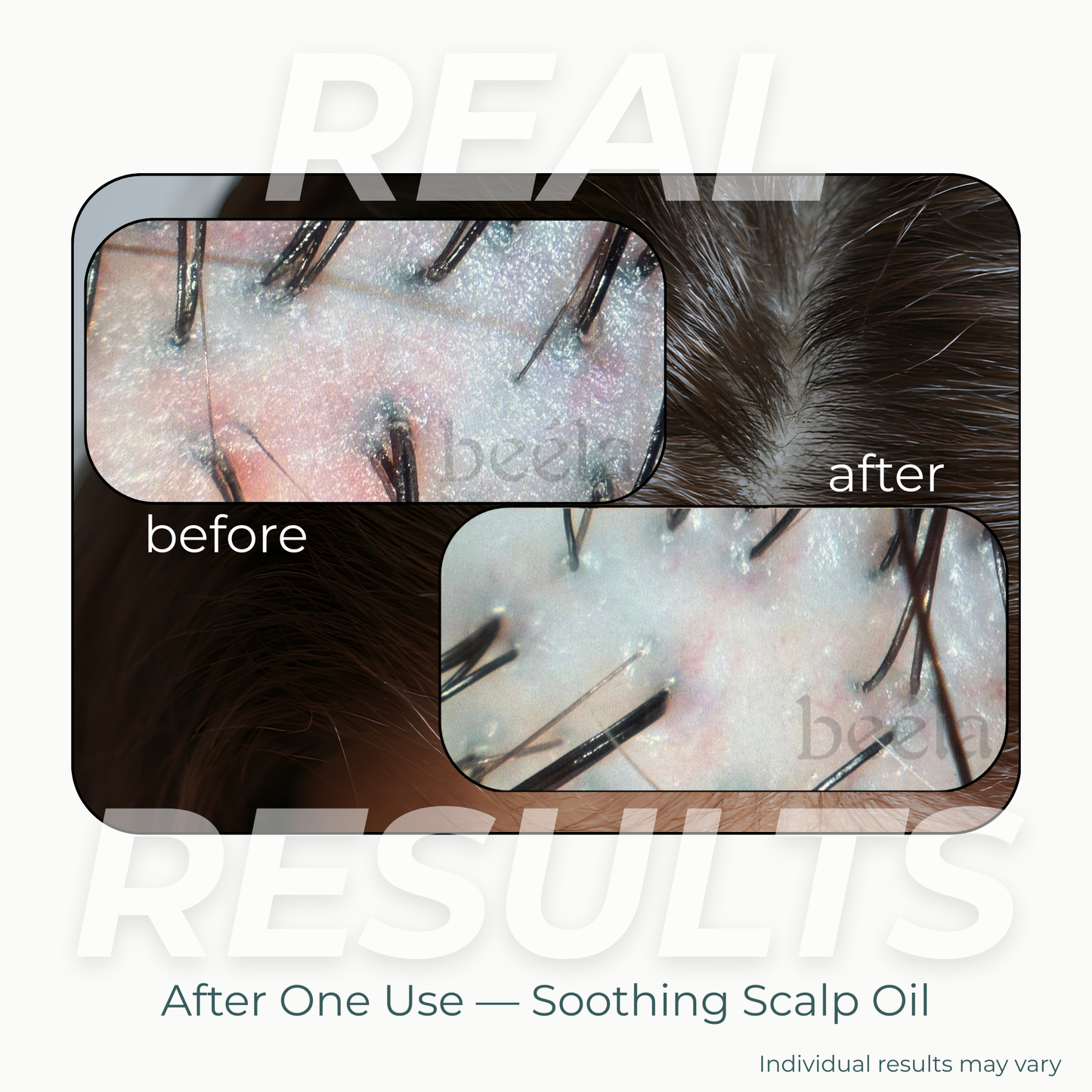 Soothing Scalp Oil - 1oz
