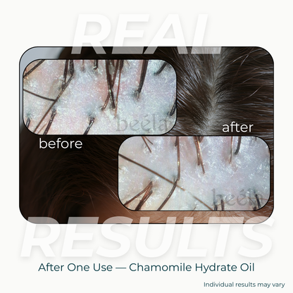 Chamomile Hydrate Scalp Oil - 2oz